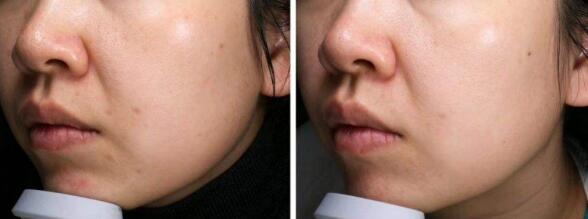 湛江東盟整形醫(yī)院值得信賴嗎