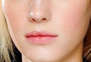 鄭州二附院馬富廉醫(yī)院特點(diǎn)揭秘！下頜角磨骨案例詳解！