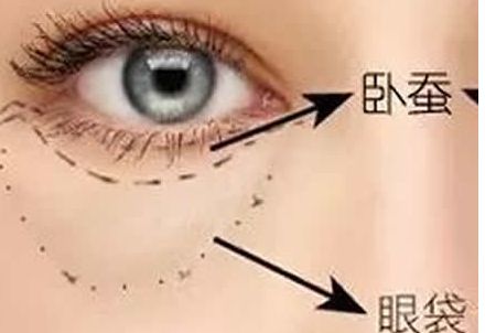 北京協(xié)和醫(yī)院隆胸案例與醫(yī)生簡介含金量如何？收費是否合理？