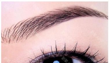 廣州做脂肪填充哪家醫(yī)院專業(yè)可靠？權(quán)威醫(yī)院排行榜揭露