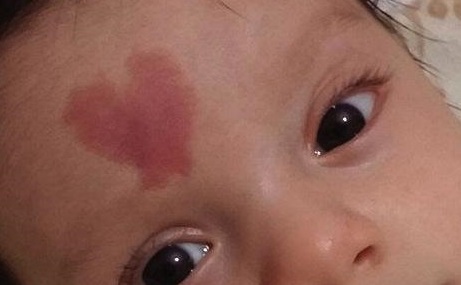 惠州心壹美醫(yī)院是技術(shù)專業(yè)的醫(yī)療機構(gòu)嗎熱門項目及價格表費用清單公布，值得考慮嗎？