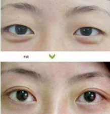 成都哪些醫(yī)生能力出眾進(jìn)行隆胸術(shù)？年度隆胸好醫(yī)生十大排名出爐