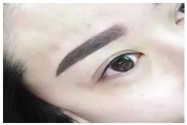 范希玲扇形雙眼皮的特點及時尚元素解析！了解22年費用表，揭秘這一時尚風(fēng)格的關(guān)鍵所在