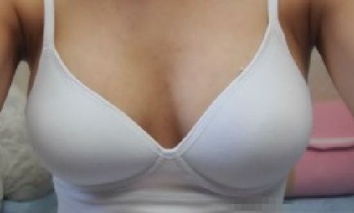 天后朱東磊鼻子整形效果如何？專家評(píng)估結(jié)果公開(kāi)解析