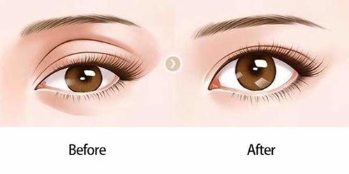 邯鄲哪家醫(yī)院能夠有效改善厚唇問題？如何選擇醫(yī)院？