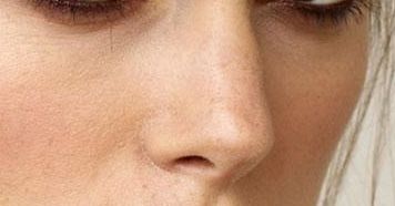 西安哪家醫(yī)院治療雙眼皮效果專業(yè)？達人推薦，好口碑！