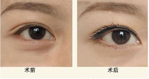 【獨家】上海九院整形科醫(yī)生王琛醫(yī)生的專長與案例分享