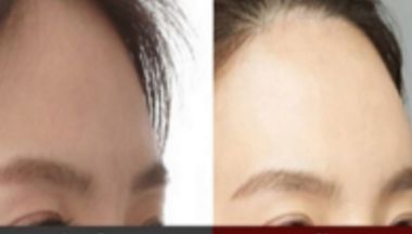 廈門哪些醫(yī)院擁有的抽脂技術(shù)，等你來發(fā)現(xiàn)