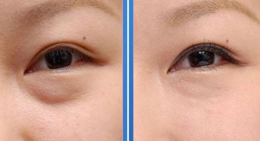 西安祛斑醫(yī)院綜合排行榜公開，全面解析正規(guī)專業(yè)醫(yī)院推薦