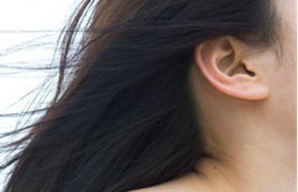 切眉后消腫需要多久才能恢復(fù)正常？需要注意哪些事項(xiàng)來(lái)促進(jìn)消腫？