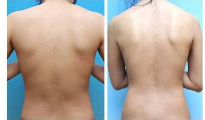 2023年長沙地區(qū)推薦的面部拉皮除皺醫(yī)生排行榜公開醫(yī)生背景介紹詳細版