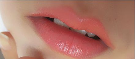 秦皇島頂級(jí)醫(yī)院一次雙眼皮手術(shù)價(jià)格揭秘，專(zhuān)家推薦+真實(shí)案例告訴你！