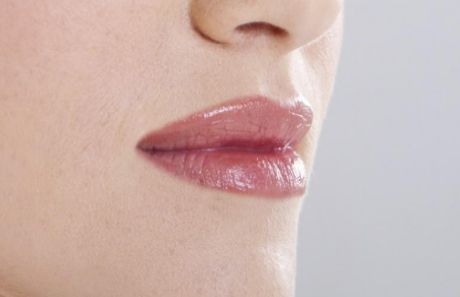 廣醫(yī)一院整形美容科：醫(yī)生實力強，雙眼皮案例為佐證