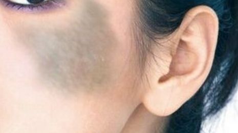 鎮(zhèn)江隆鼻醫(yī)院推薦：鎮(zhèn)江做隆鼻，這幾家醫(yī)院不可錯過！