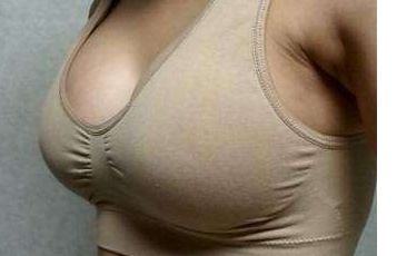 朱海男雙眼皮手術(shù)效果及經(jīng)驗分享！是否可信賴？面臨怎樣的結(jié)果？趕緊探究吧！