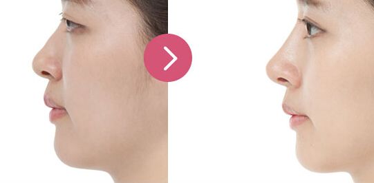 北京大學(xué)口腔醫(yī)院優(yōu)秀正畸科醫(yī)生推薦！