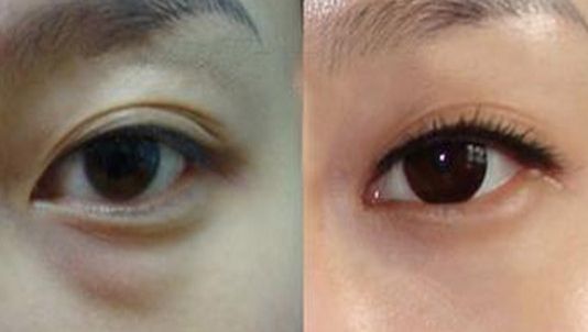 廣州哪家整形醫(yī)院最受好評？TOP3推薦！