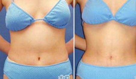 衡陽比較好的醫(yī)院美容科專家團(tuán)隊(duì)推薦，價(jià)格公開透明！