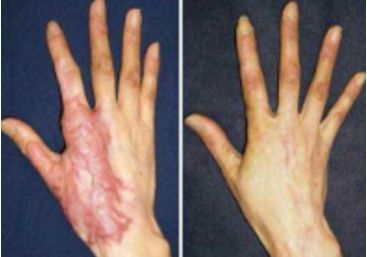 深圳市綜合整形醫(yī)院排行榜，口碑好的醫(yī)療機(jī)構(gòu)大揭秘！