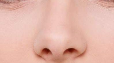 泉州哪家醫(yī)院在脂肪填充整形領域有口碑？重新認識久負盛名的歐菲整形