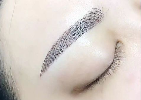 激光煥膚中心：祛眼袋效果有口皆碑，多位專家力薦