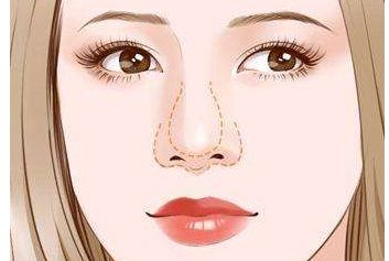 濟(jì)南哪家醫(yī)生做雙眼皮效果好？謝燕燕醫(yī)生實力及案例揭秘！