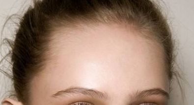 山上醫(yī)療科技帶來(lái)的激光祛斑解決方案解密