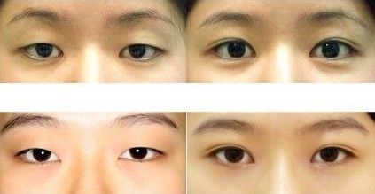 上海五位頂級(jí)整形專家鼻王盤點(diǎn)，你無(wú)法想象的專業(yè)能力，只有你才知道的顛覆美麗！