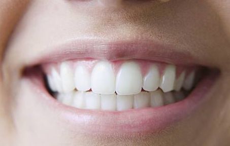 上海九院周慧芳醫(yī)生的雙眼皮手術效果一覽