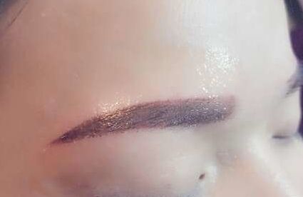 嘉興哪家雙眼皮整形醫(yī)院技術實力超群，備受矚目！