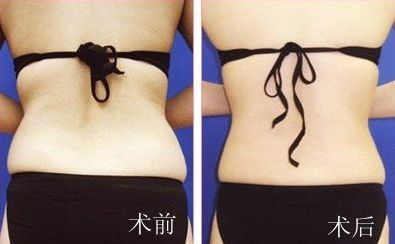 廣州非常受歡迎的整形專家解密！揭秘絕頂名醫(yī)，為你帶來全新穎解析！