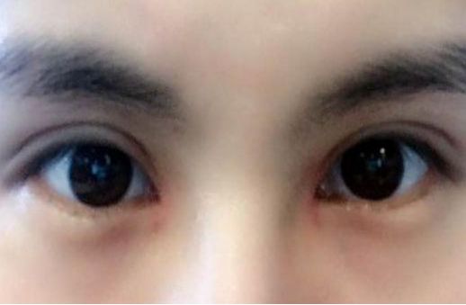 專家執(zhí)針絕活，您知道哪位醫(yī)生在注射物取出方面最厲害嗎？獨(dú)特手法排行榜前五名大揭曉