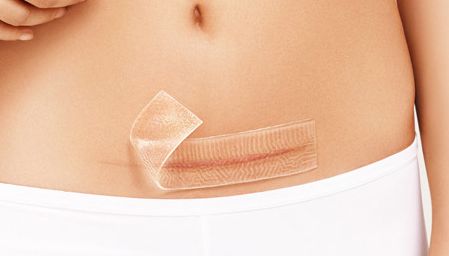 上海九院王琛隆鼻術(shù)后圖及專家簡介，完成理想的鼻梁不再遙不可及！