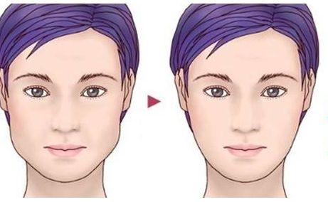 上海著名整形醫(yī)生李圣利的鼻子審美效果如何？網(wǎng)友親身經(jīng)歷分享實(shí)例。