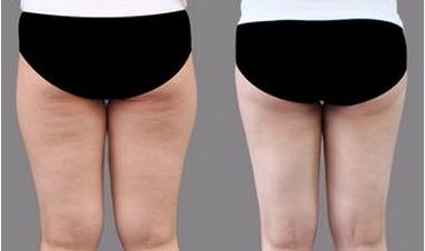 上海頂尖整容醫(yī)師團隊曝光：專為改善臉型而生！