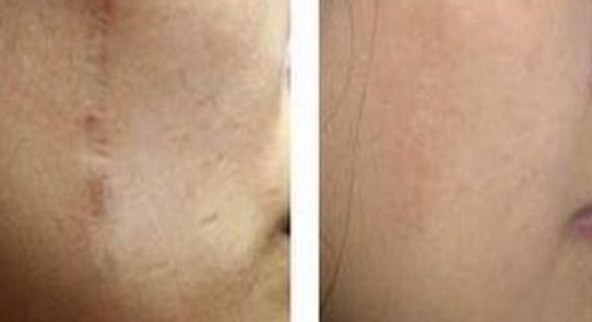 廣州華美整形美容醫(yī)院的醫(yī)生推薦和整形項目收費情況詳解