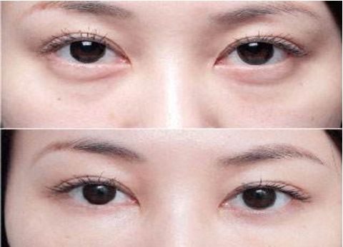 杭州專業(yè)整容醫(yī)療機構排行榜大揭秘！藝術之星醫(yī)療集團對比時光整形大賽！真實原因還原無遺！