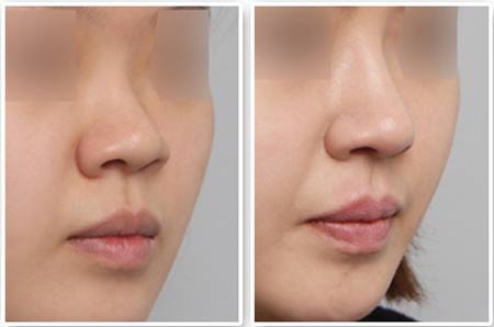 廣州愛來醫(yī)療美容門診部口碑怎么樣？醫(yī)院醫(yī)生和地址如何？門診部真的靠譜嗎？