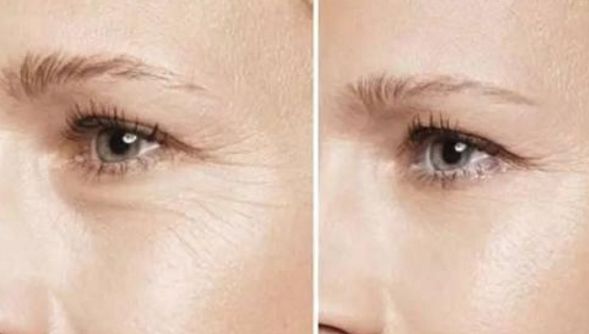 徐州二院哪位醫(yī)師擅長雙眼皮手術(shù)？權(quán)威推薦榜單+手術(shù)費用明細參考