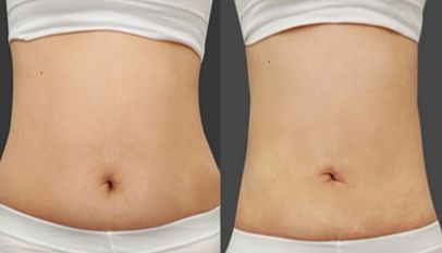 青島的美容整形醫(yī)院排名，這些備受贊譽(yù)的醫(yī)療機(jī)構(gòu)紛紛登上排行榜