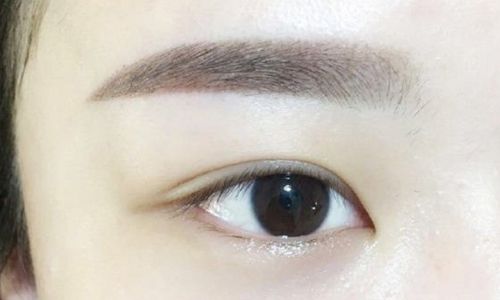 袁斯明醫(yī)生手術(shù)等待時間？術(shù)后恢復效果如何？眼部整容40天現(xiàn)圖曝光！