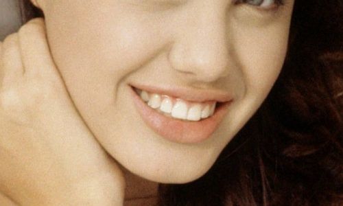 北京八大處整形外科院內(nèi)資深專家團隊帶您探尋雙眼皮案例精彩賞析