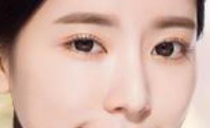 上海薇琳全身吸脂效果好嗎？