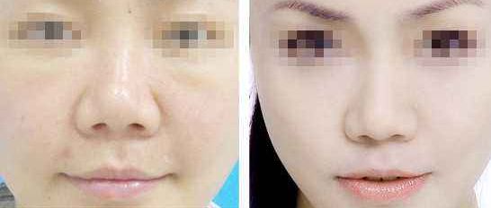 西安整形醫(yī)療機(jī)構(gòu)搶先座次，多家私立醫(yī)美機(jī)構(gòu)震撼效果排在最前！