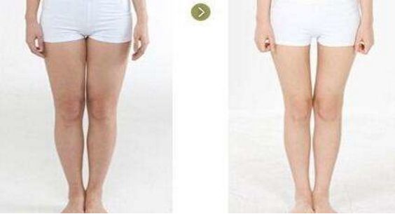 2023年上海副乳吸脂手術(shù)七大名醫(yī)推薦，醫(yī)生排行榜震撼來(lái)襲