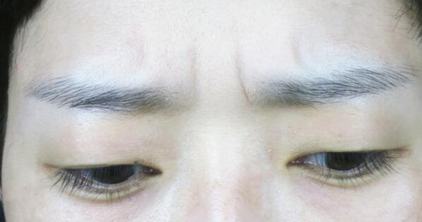 河北醫(yī)科大學(xué)第二醫(yī)院項(xiàng)目有哪些？醫(yī)生技術(shù)如何提供？