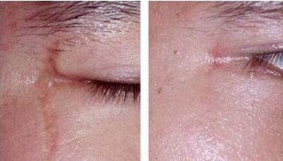 陳信愷鼻子整形成就供您參考