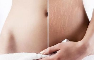 合肥最受推薦的去眼袋整形醫(yī)院，排行榜TOP6呈現(xiàn)您！