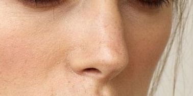 2023年鄭州有哪些受歡迎的植發(fā)醫(yī)院？醫(yī)美行業(yè)走向解析