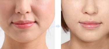 上海最佳隆鼻醫(yī)生推薦！5位實力醫(yī)生值得參考